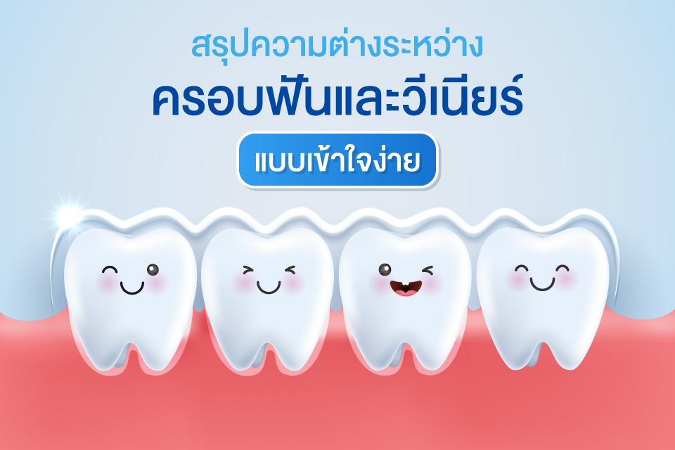วีเนียร์ vs ครอบฟัน เลือกแบบไหนให้เหมาะกับฟันคุณ