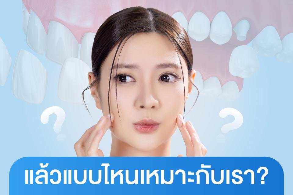 วีเนียร์ vs ครอบฟัน เลือกแบบไหนให้เหมาะกับฟันคุณ