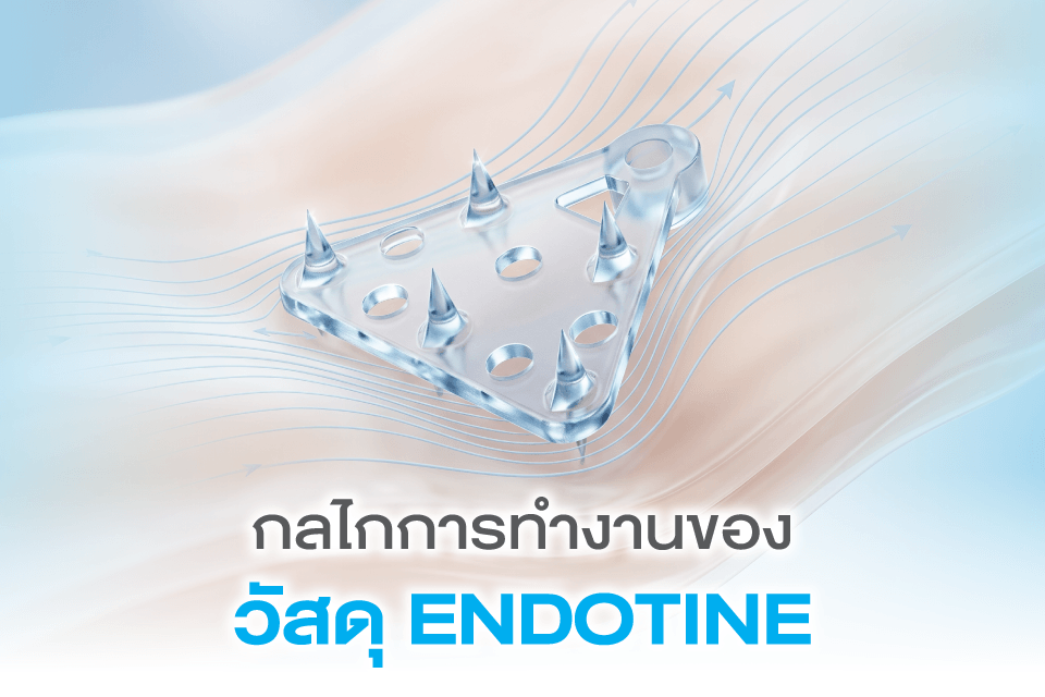 5 คลินิกทำ Endotine ที่น่าจับตาสำหรับสาวๆ ปี 2026